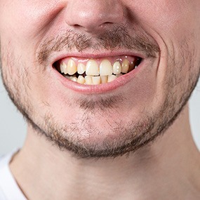 Closeup of a crooked smile