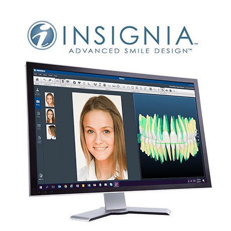 Image of Insignia advanced orthodontic smile design on computer screen
