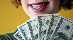 average-cost-for-braces
