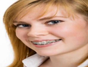 free-orthodontist-consultation295x225