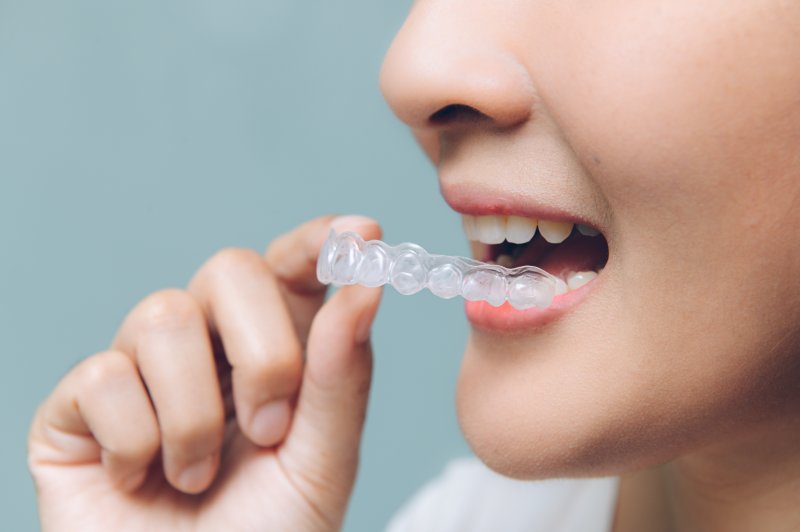 a young woman preparing to insert a clear aligner into her mouth 
