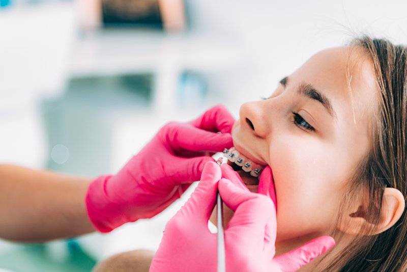 Girl during braces removal