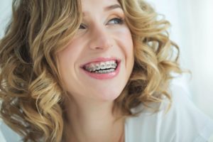 Woman with blond hair wondering about braces treatment time