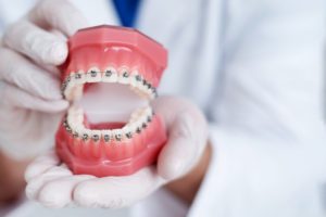 a dentist holding a model of teeth wearing braces