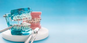 Two sets of model teeth with braces on a white stand with dental instruments in front of a light blue background