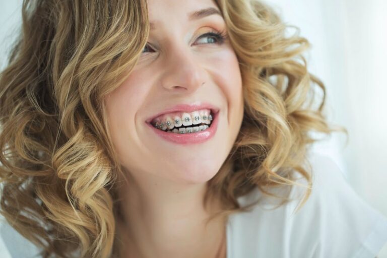 Why Do My Teeth Feel Loose With Braces? Serenity Orthodontics