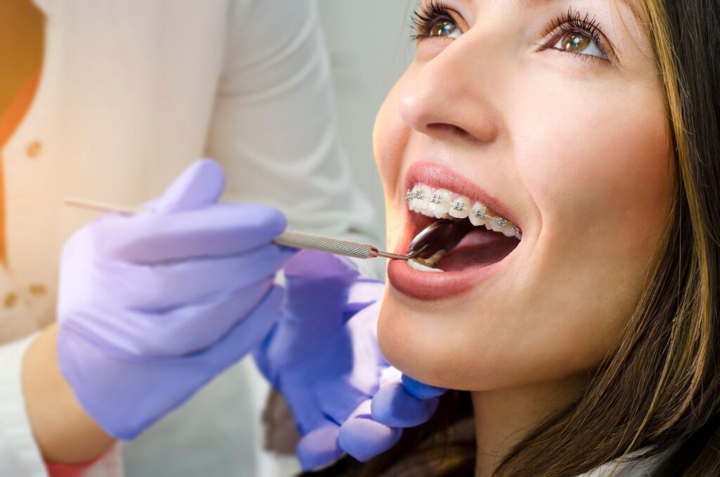 Woman with brown eyes and braces opening mouth for dental exam