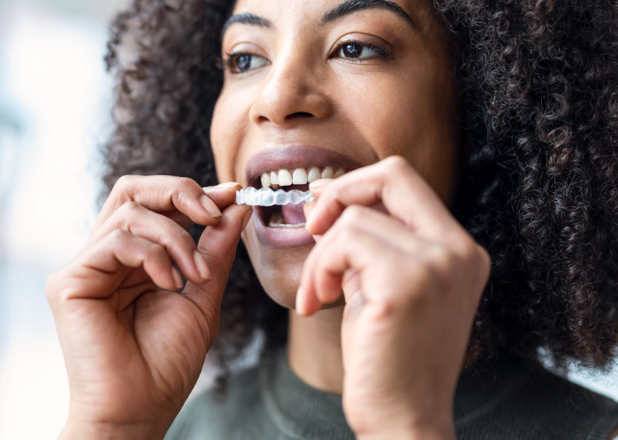 Woman putting on clear aligner