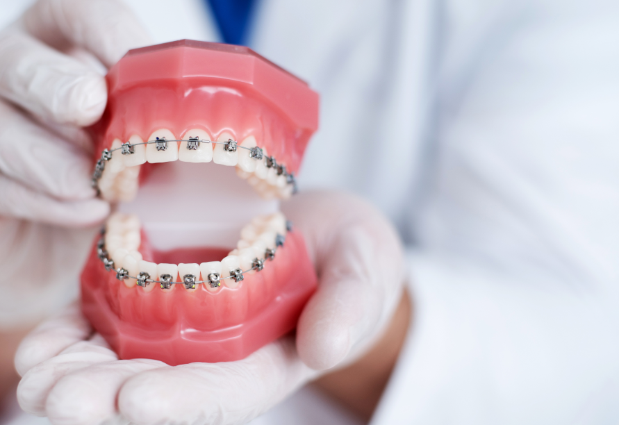 Dentist holding model teeth with dentures